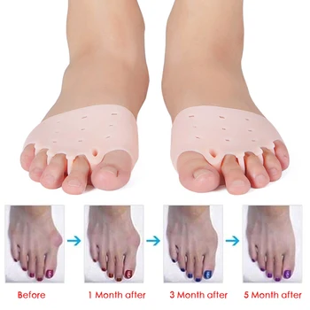 2 buc Silicon Tep Separator de Inflamație la picior Os Ectropion Degetul mare de Reglare Deget de la picior Exterior Aparat Picior de Îngrijire Instrumente Hallux Valgus Corector