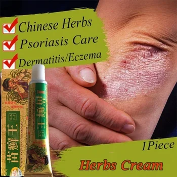 1 buc de Îngrijire a Sănătății Pielii Ciuperca Anti Bacteriene Crema Naturale, Ierburi Chinezești Crema Onitment pentru Psoriazis, Dermatită, Eczeme Tratament