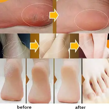 33/55gPowerful Tradițională Chineză Anti-Uscare Crack Repair Crema de Picioare Picior Spart Îndepărtarea Mort de Îngrijire Mână Toc Piele Crema L8R9